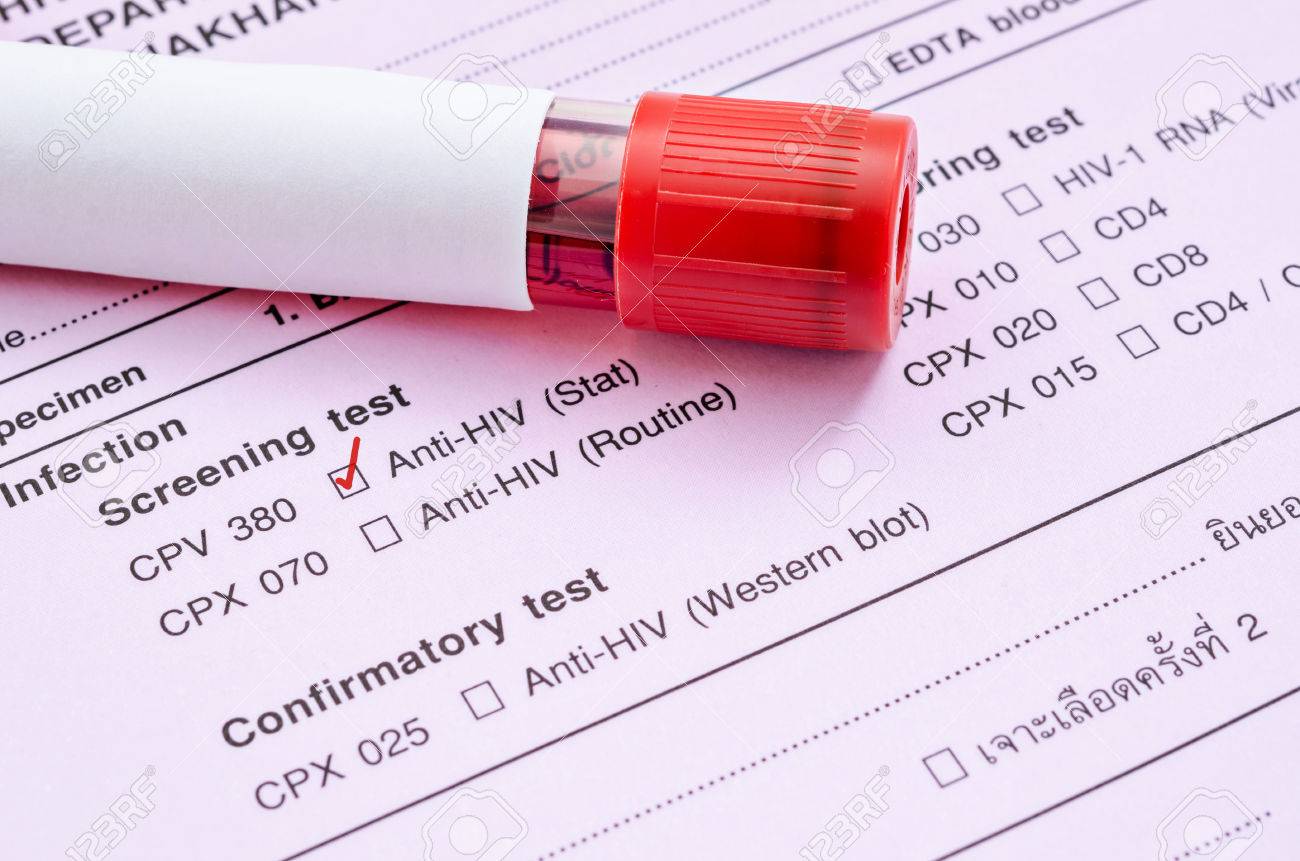Comment faire un test de paternité ? – Pas comme les autres